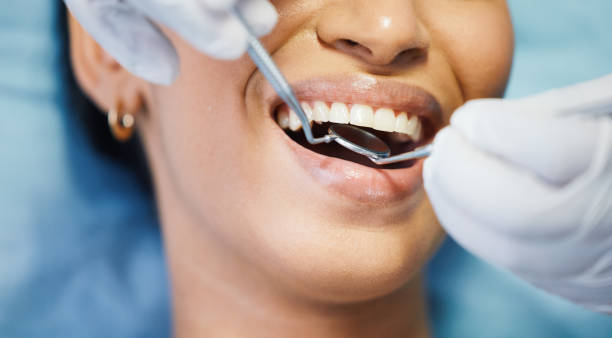 Best Mobile Emergency Dentist in Yreka, CA