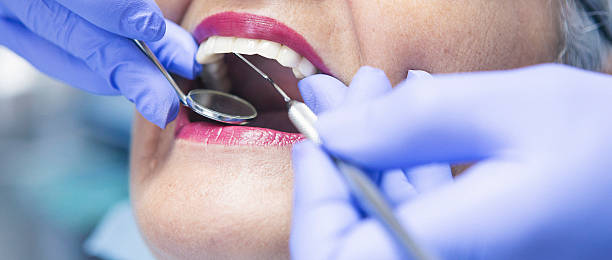 Best Emergency Dental Extractions in Yreka, CA